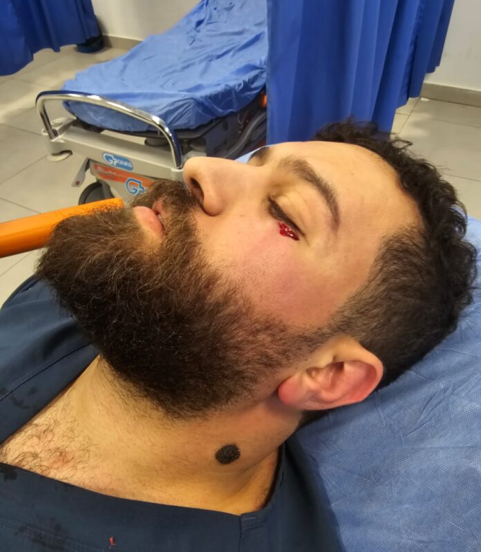 الاعتداء على طبيب في مستشفى الامير الحسين بالبقعة الاعتداء على طبيب في مستشفى الامير الحسين بالبقعة