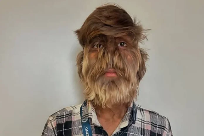 هذا الرجل الهندي دخل موصوعة غينيس .. لماذا ؟ هذا الرجل الهندي دخل موصوعة غينيس .. لماذا ؟